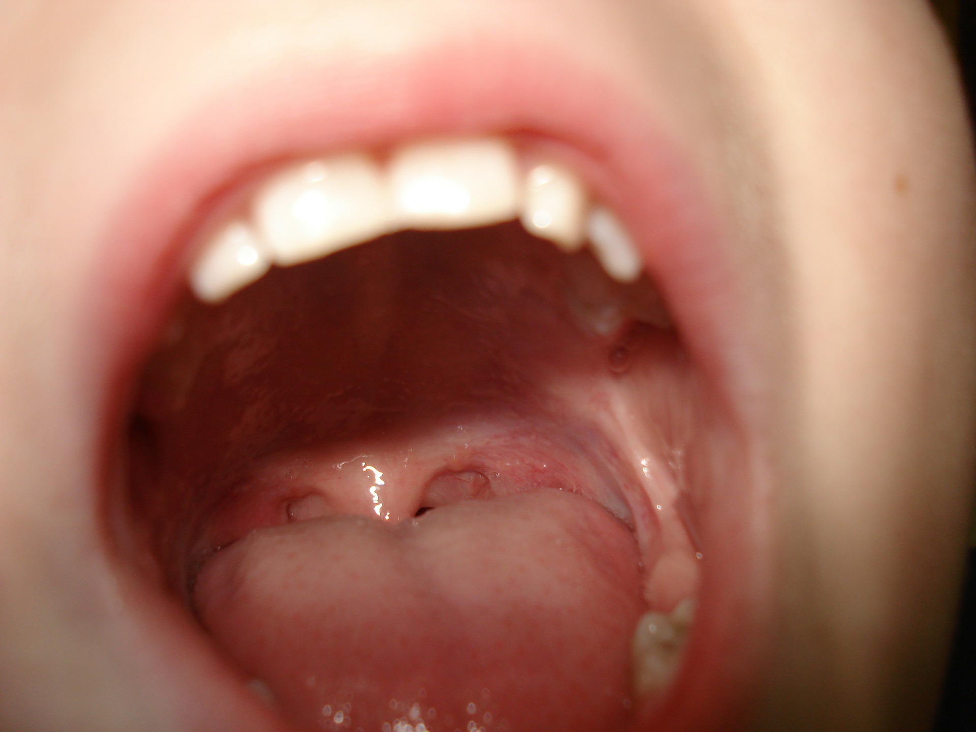 Bouche ouverte